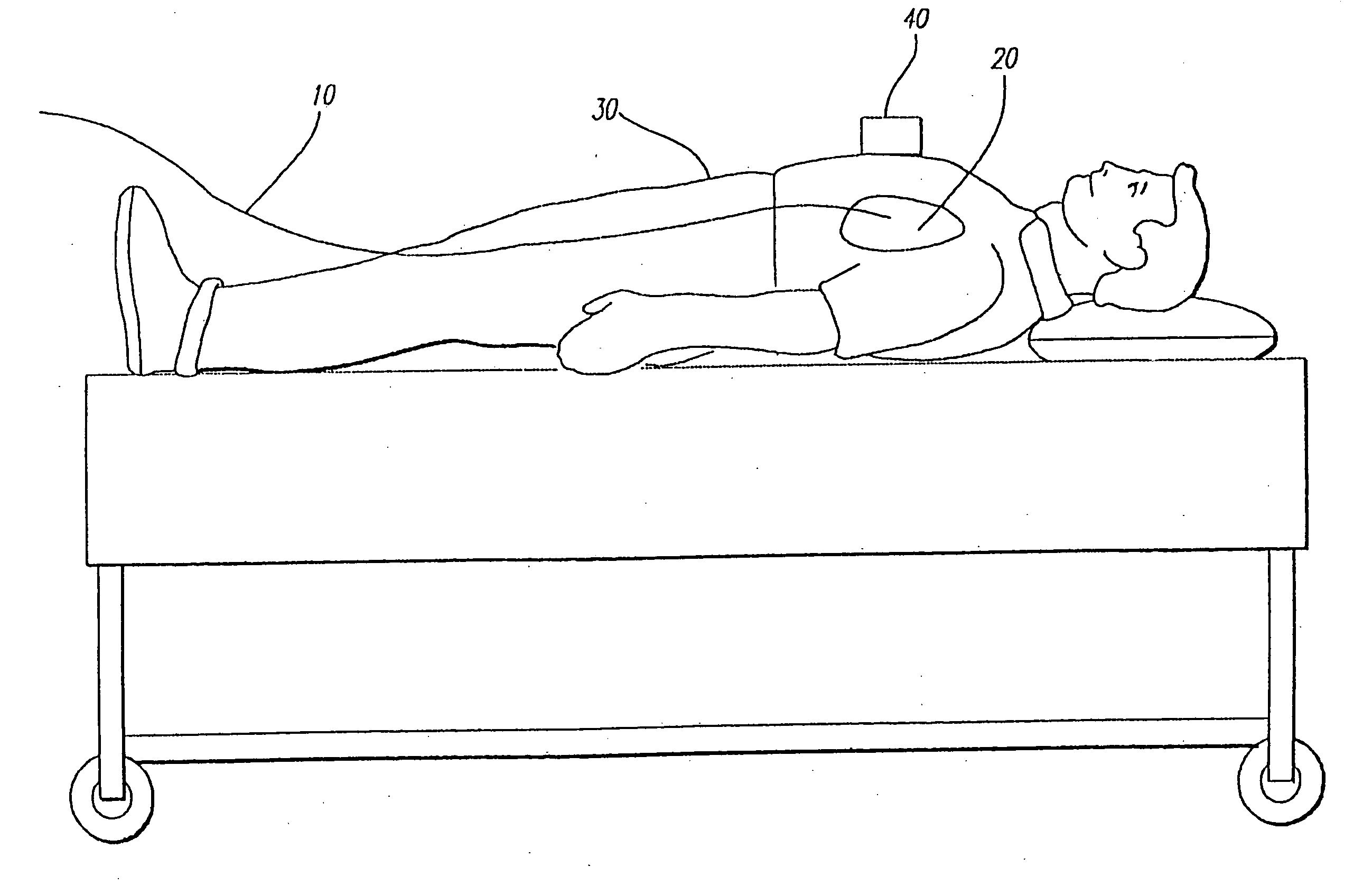 Apparatus and method for inducing vibrations in a living body