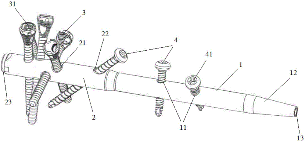 Humeral inverted intramedullary nail