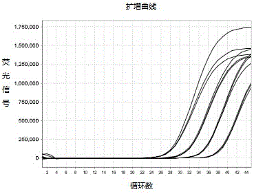 A detection kit for mycobacterium tuberculosis (tb) nucleic acid