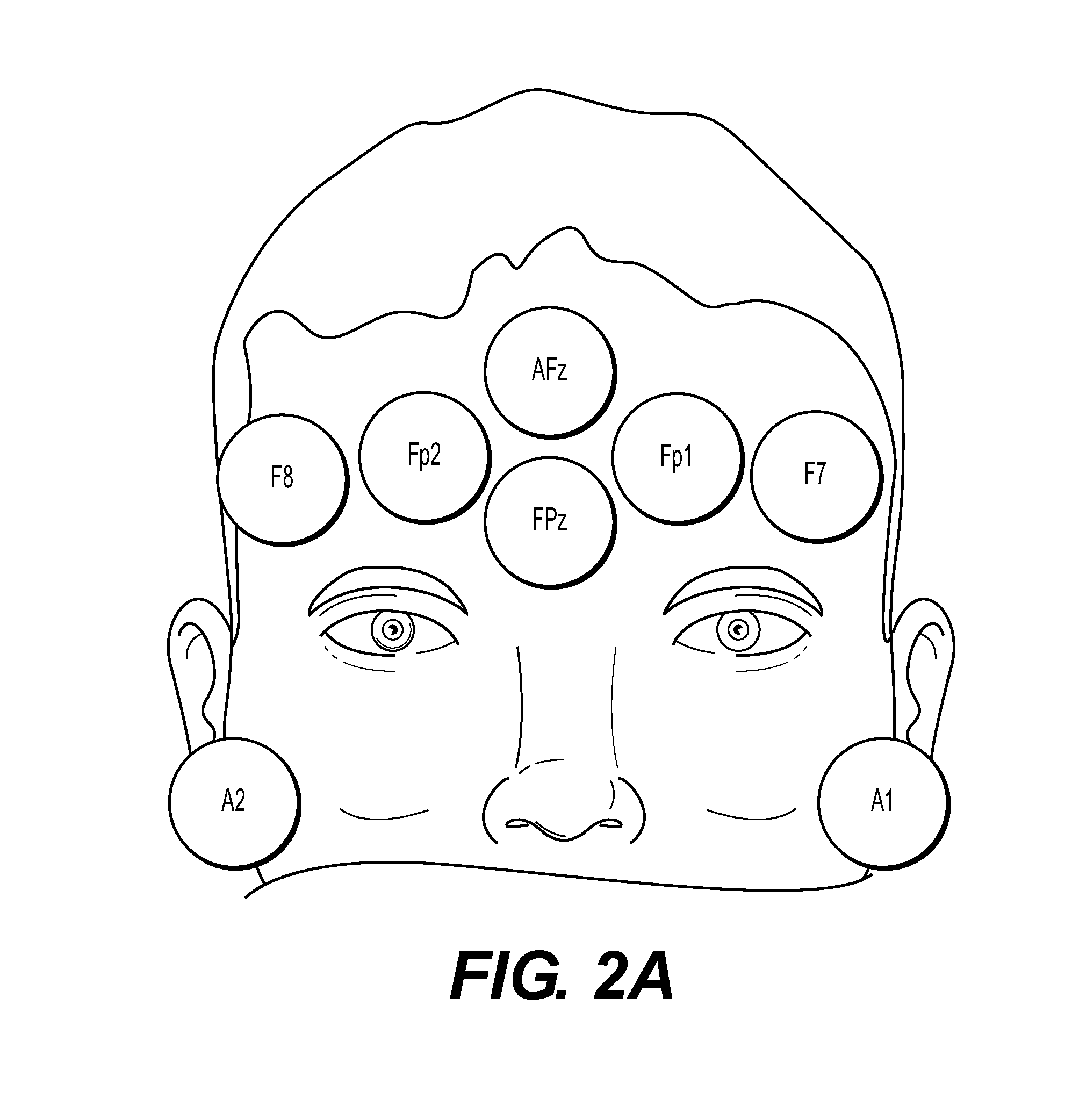 Electrode array and method of placement