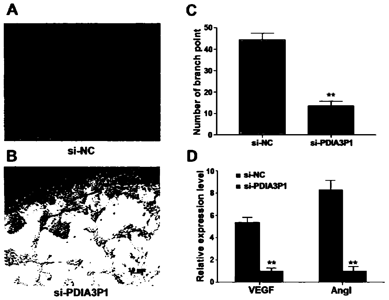 Long non-coding RNA (ribonucleic acid) and application thereof in diagnosing/treating preeclampsia