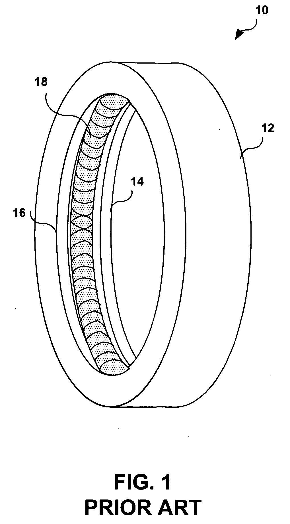 System and method of establishing an electrical connection between an implanted lead and an electrical contact