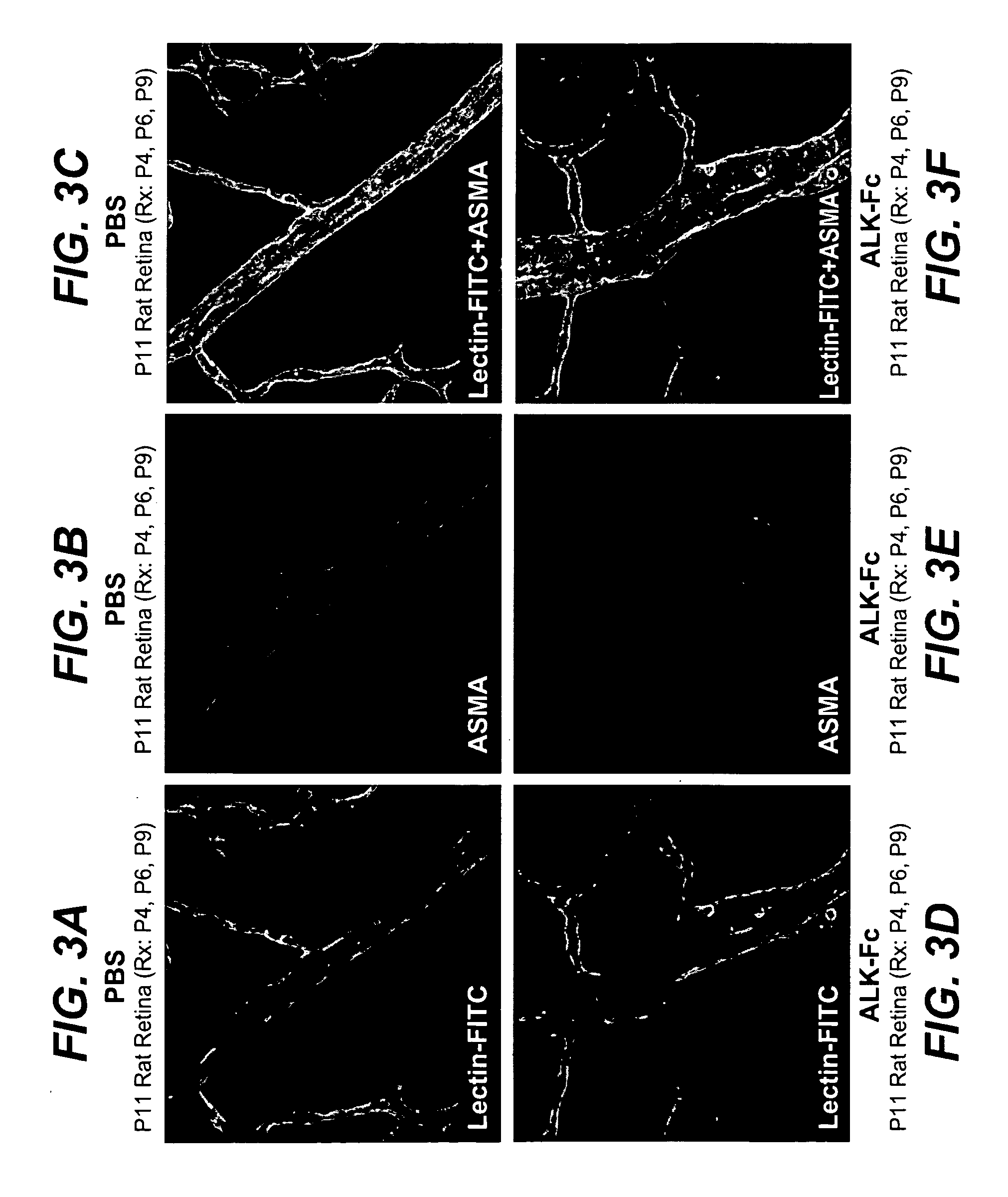 Activin receptor-like kinase-1 compositions and methods of use