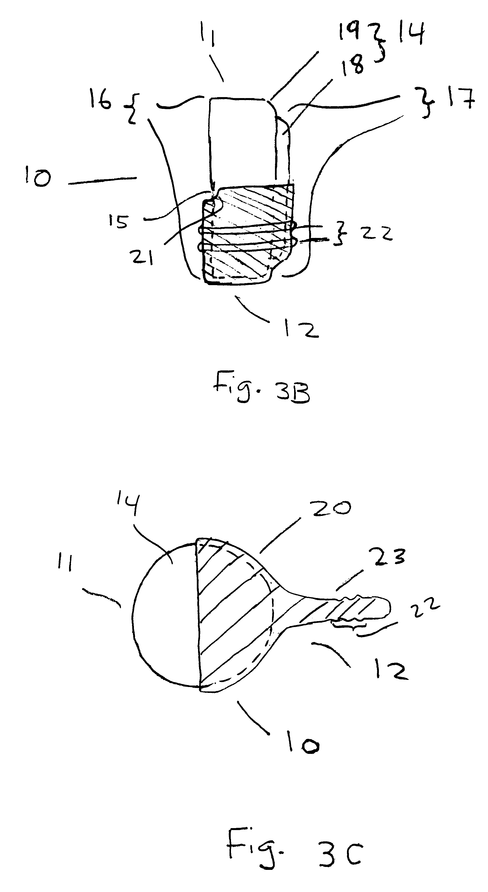 Hearing device with protruding battery assembly
