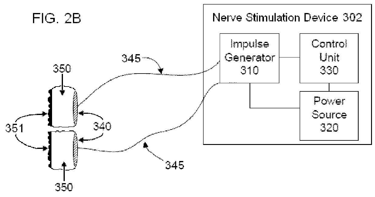 Non-invasive vagal nerve stimulation to treat disorders