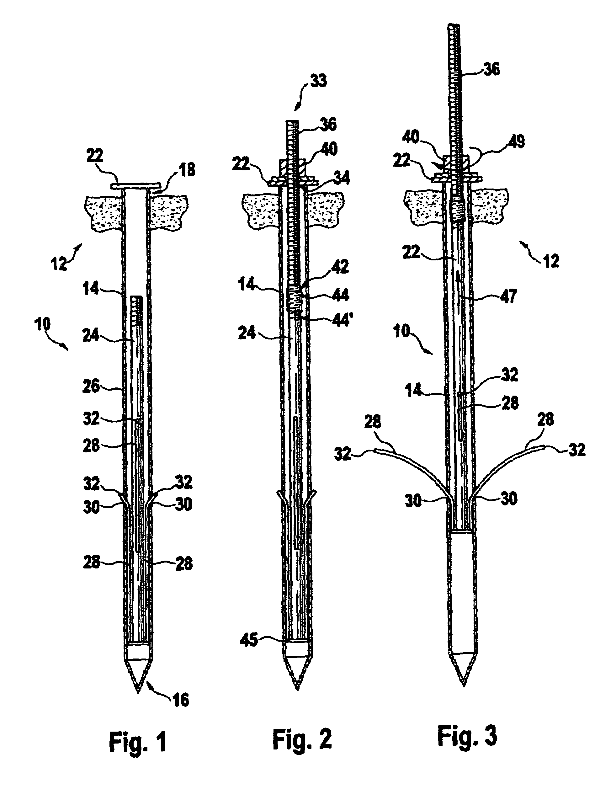 System for fixing an object in the ground by means of a peg