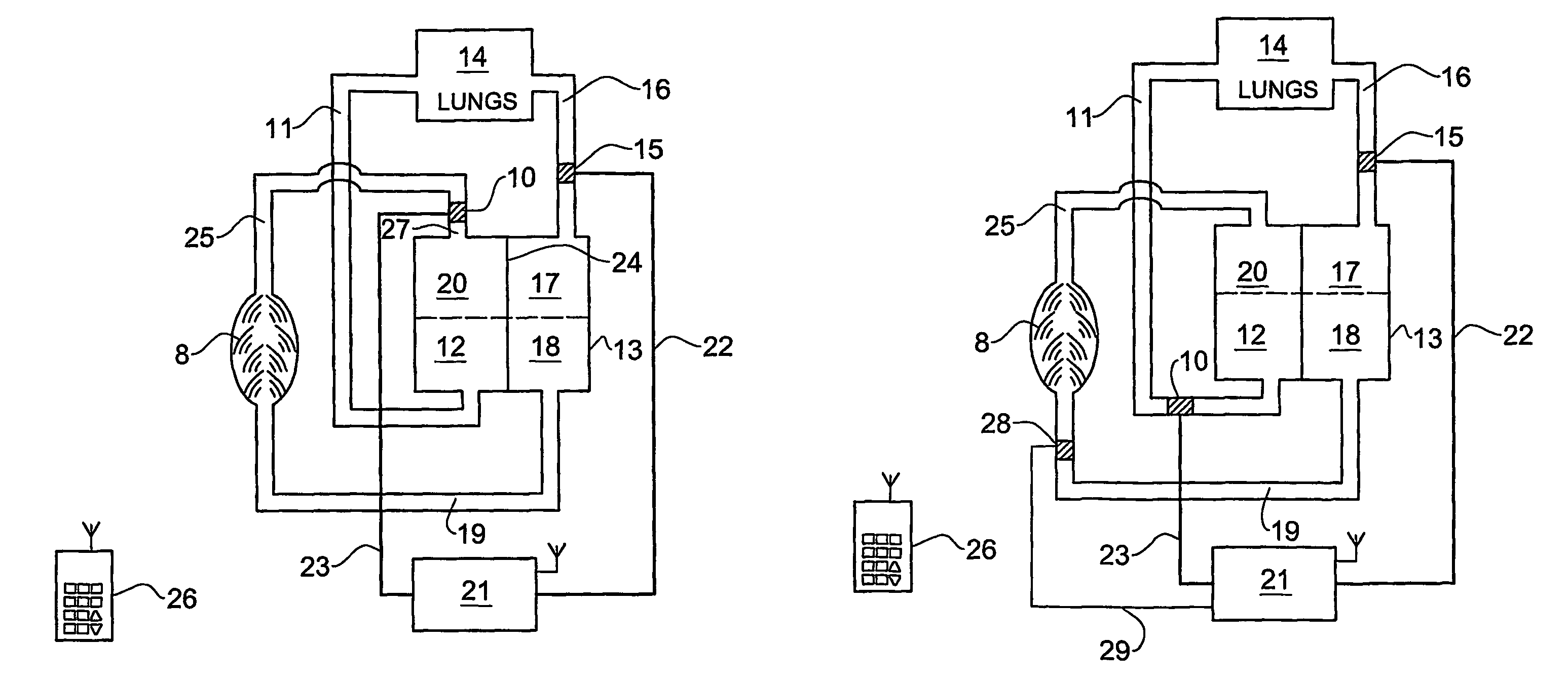 Device and method for regulating blood flow