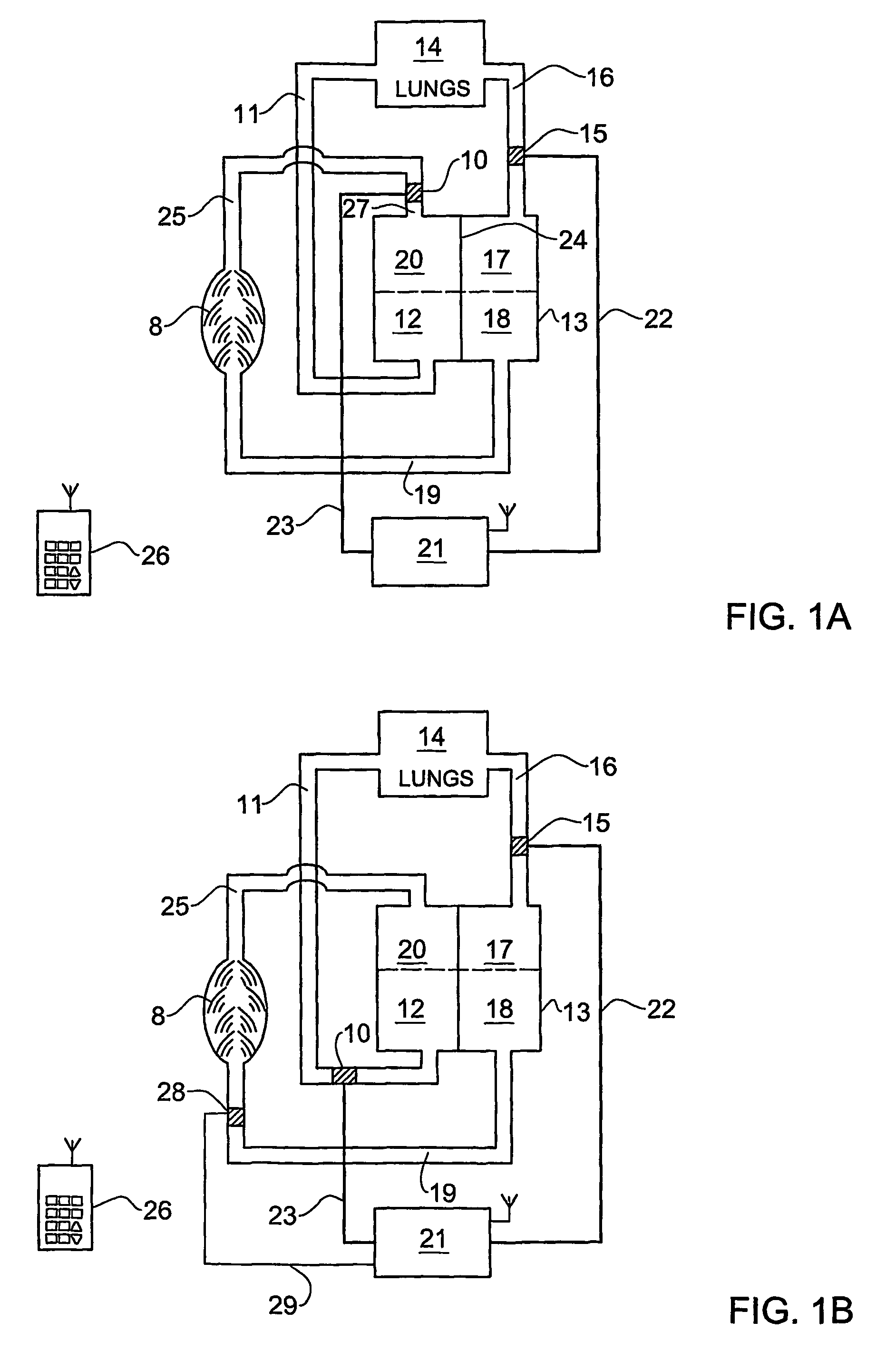 Device and method for regulating blood flow