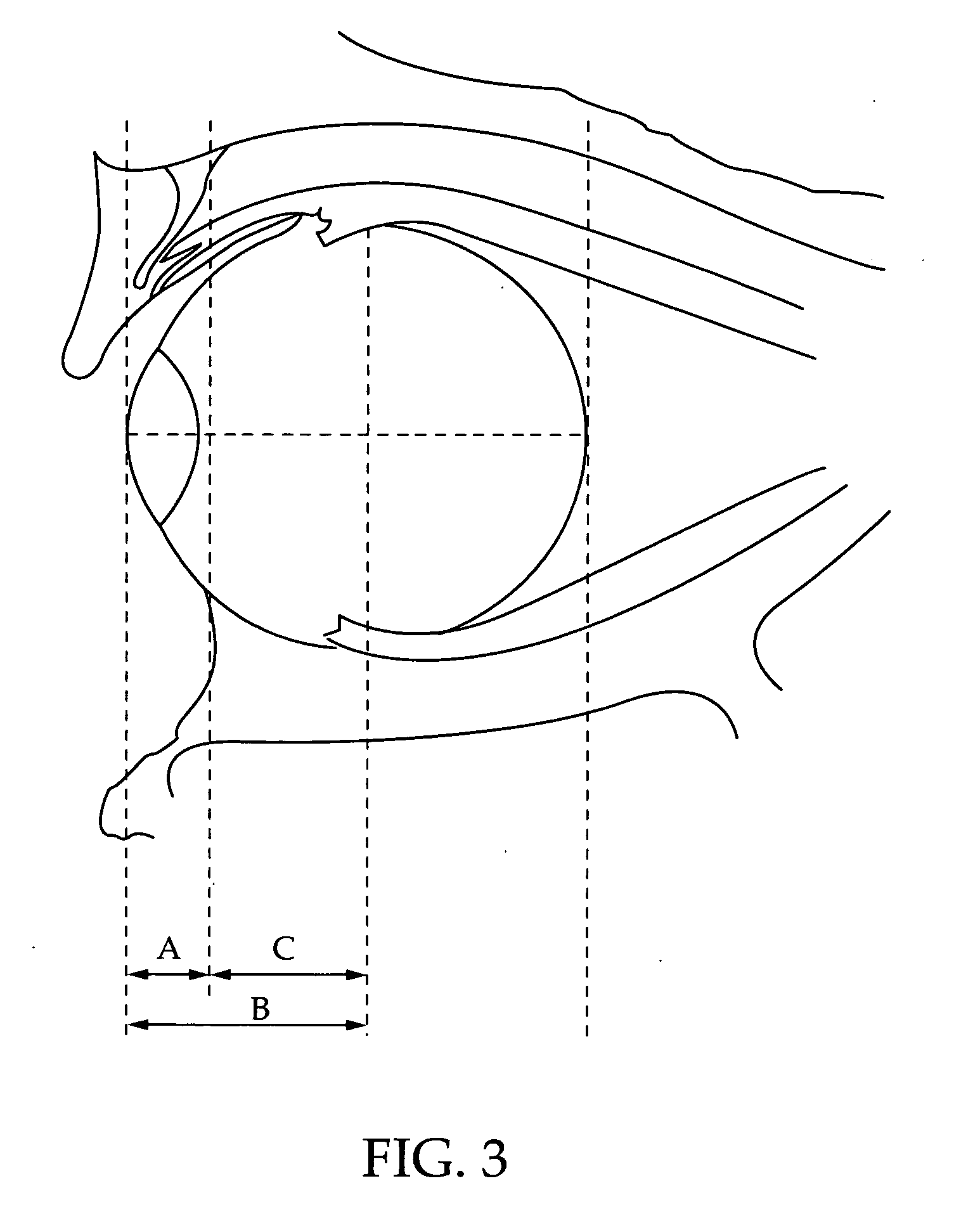 Insertion mechanism for use with a syringe