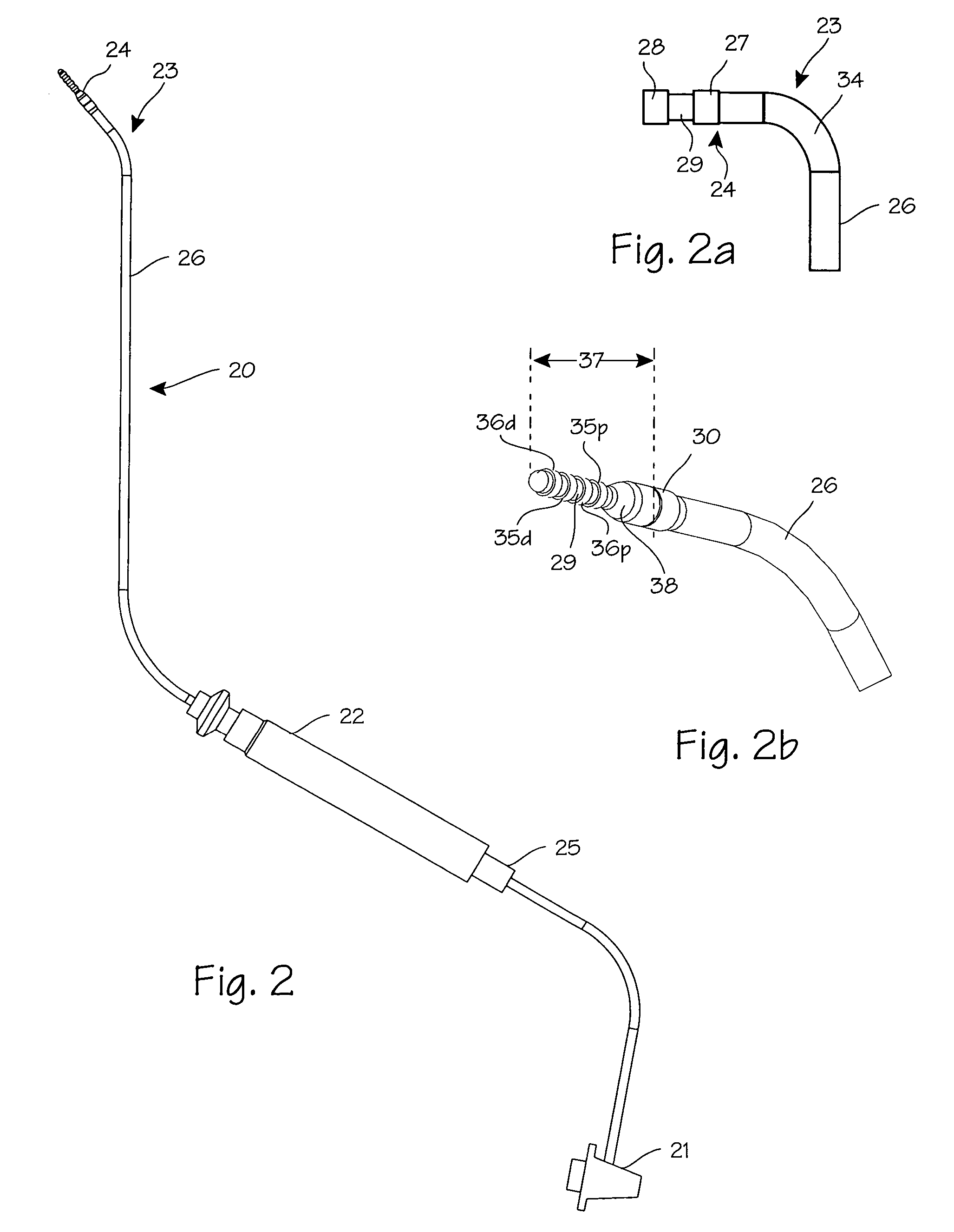 Method and apparatus for tubal occlusion