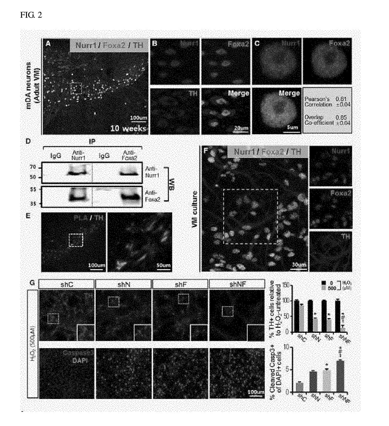 Therapeutic effects of nurr1 and foxa2 in inflammatory neurologic disorders by m1-to-m2 polarization of glial cells