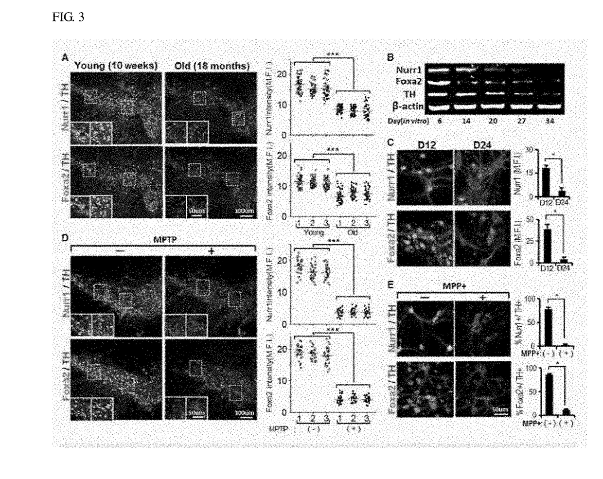 Therapeutic effects of nurr1 and foxa2 in inflammatory neurologic disorders by m1-to-m2 polarization of glial cells