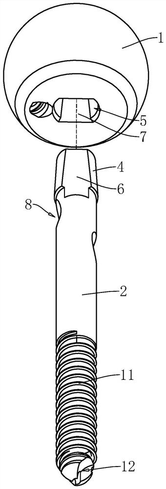 Bionic hip joint prosthesis with reserved femoral neck