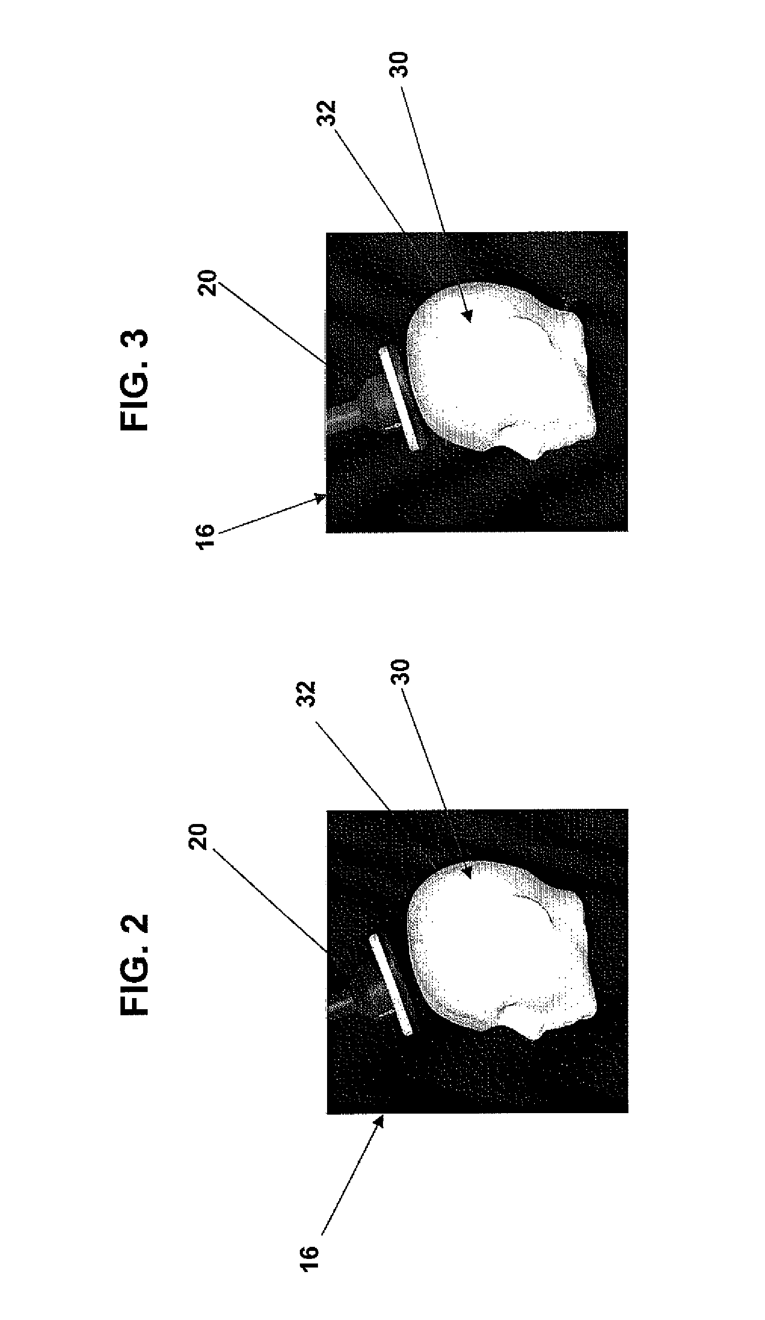 Method and apparatus for correcting an error in the co-registration of coordinate systems used to represent objects displayed during navigated brain stimulation