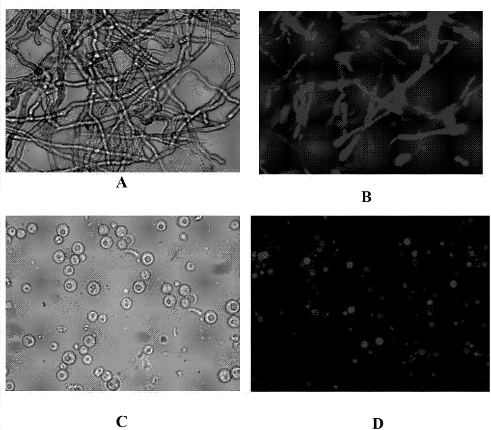 Method for high-throughput screening recombinant trichoderma reesei for efficiently expressing foreign protein