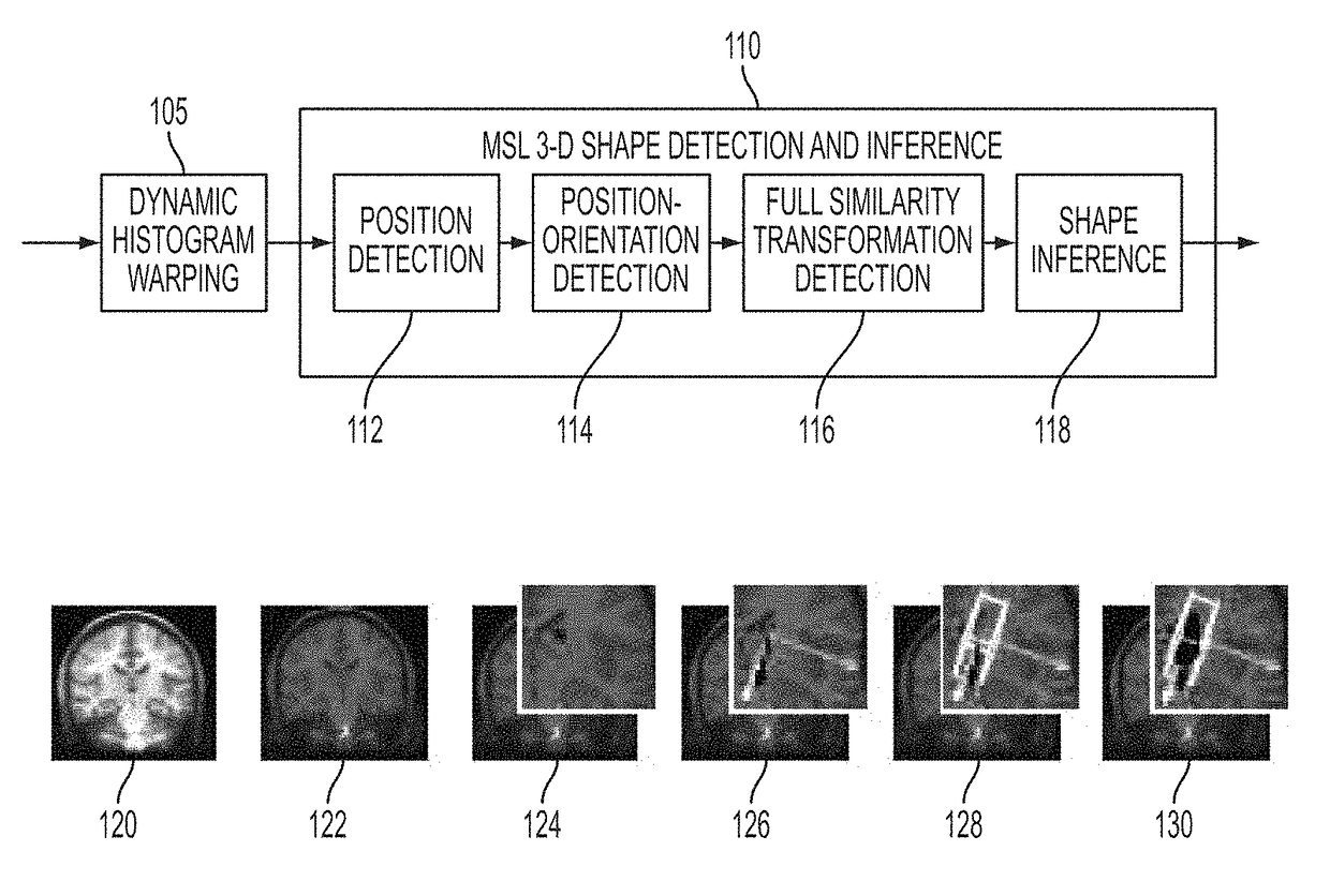 Method and system for segmentation of brain structures in 3D magnetic resonance images