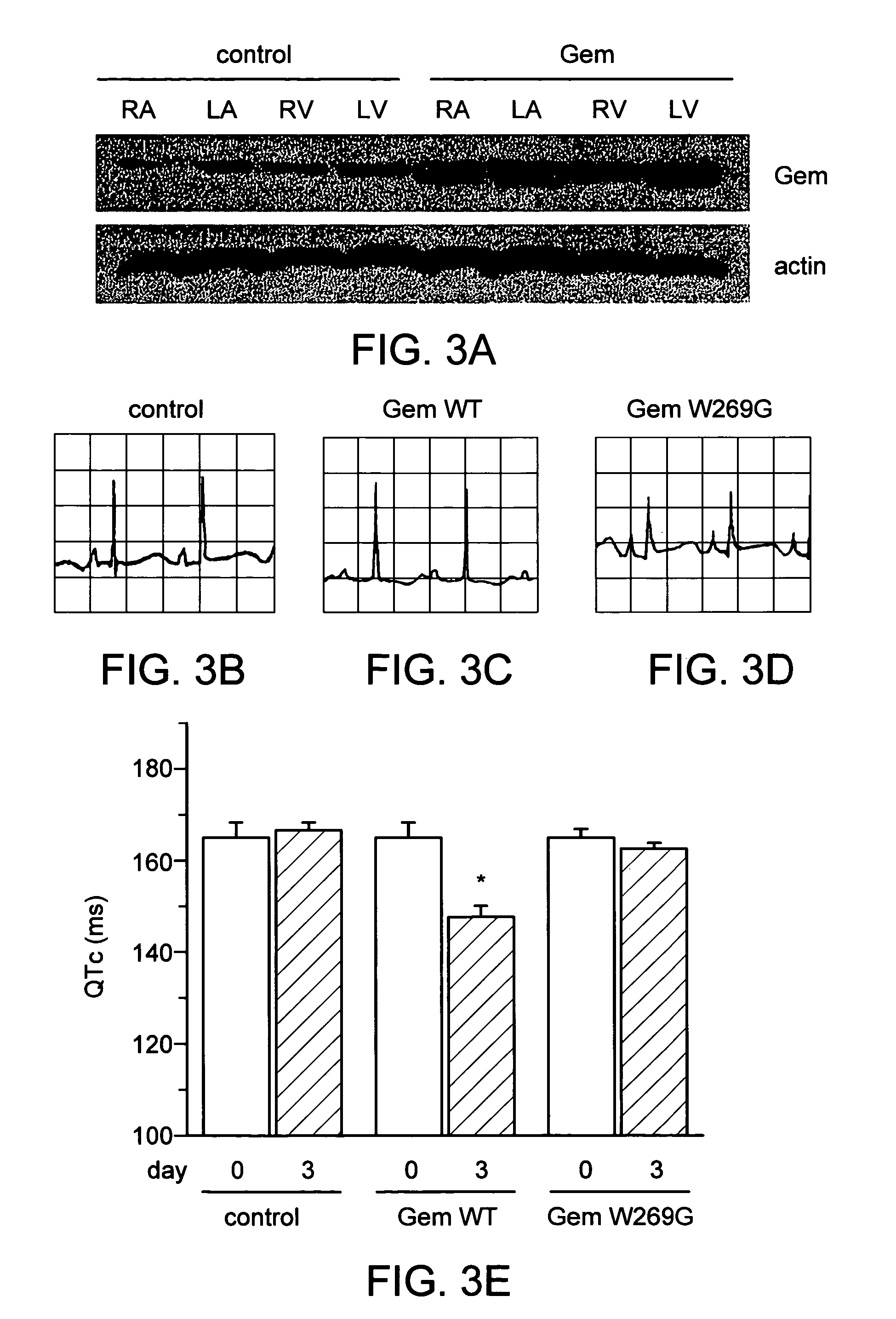 Focal calcium channel modulation