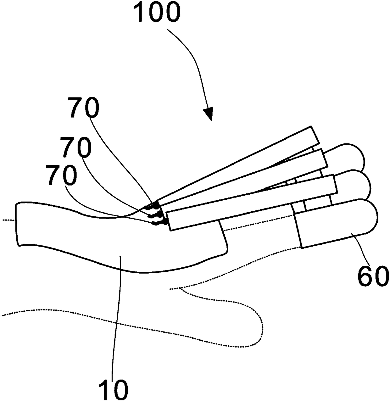 Dynamic hand assistive device