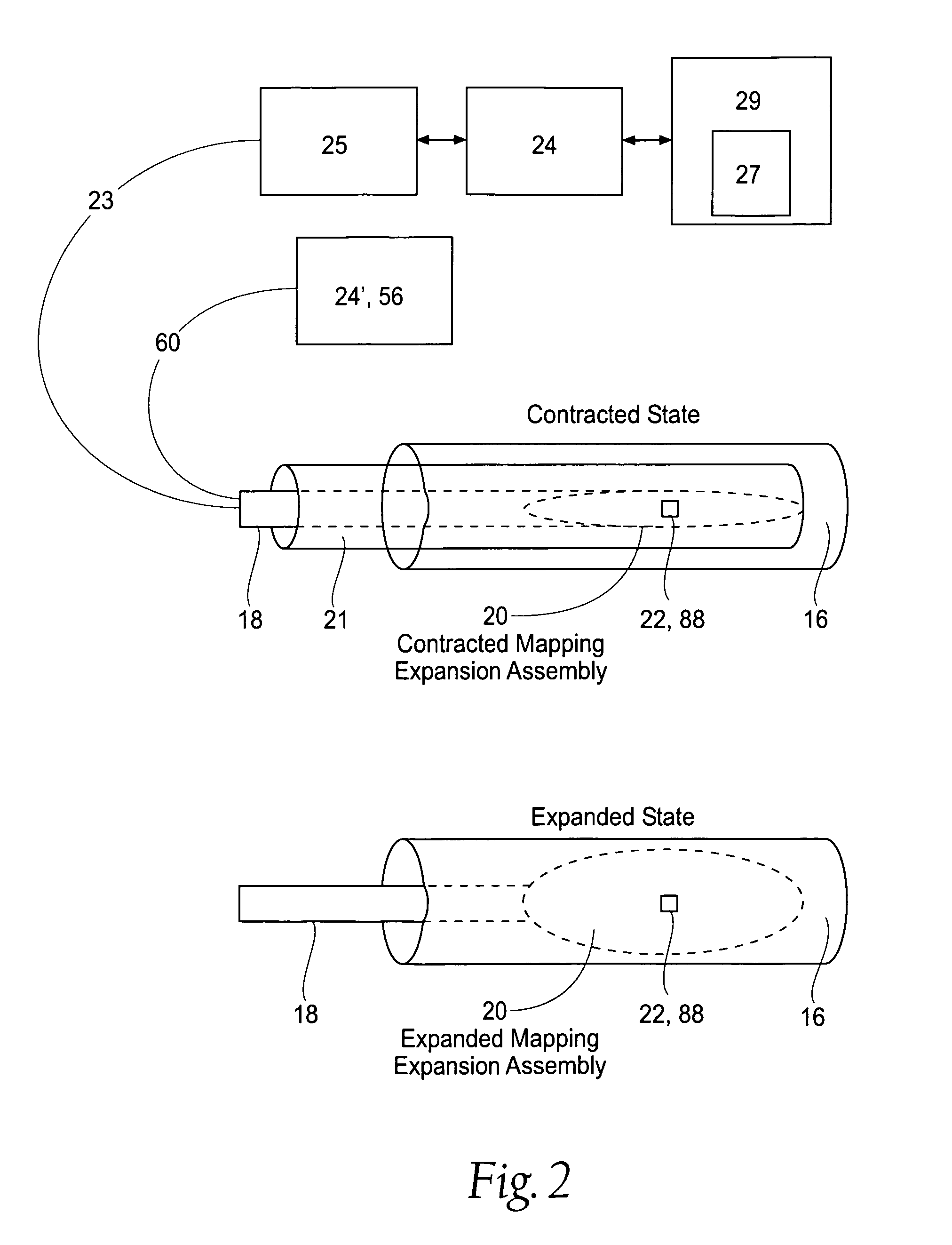Apparatus to detect and treat aberrant myoelectric activity