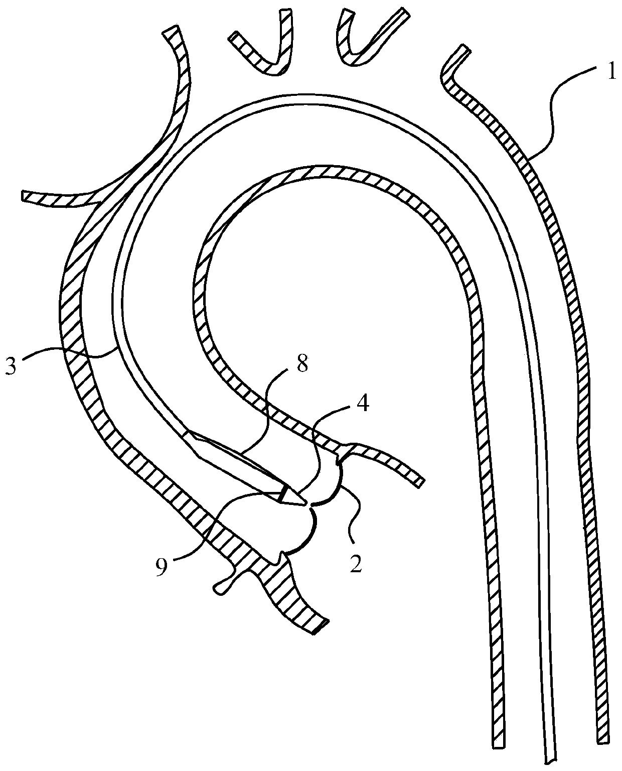 Bending-adjustable sheathed catheter and delivery system employing same