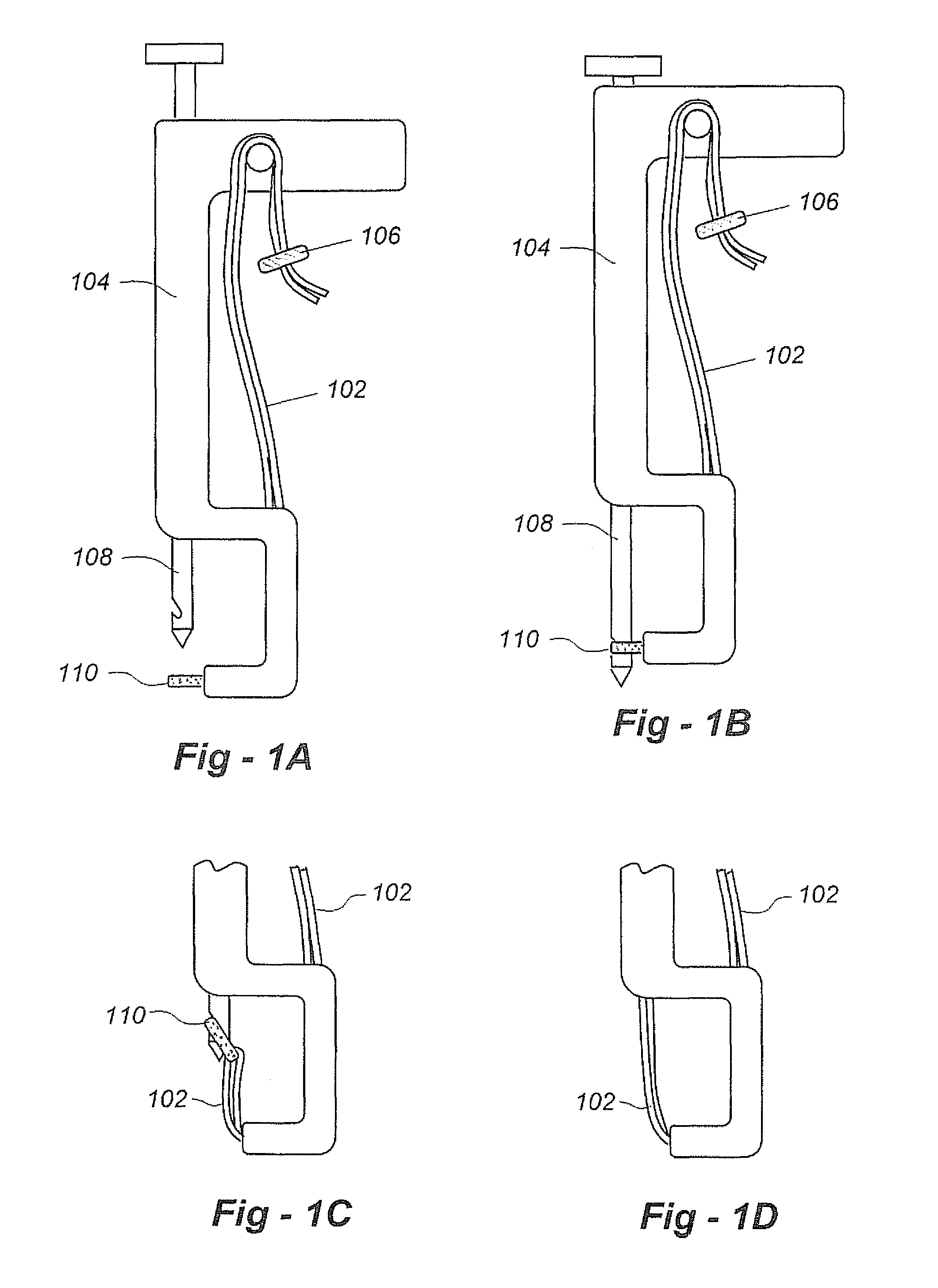 Intervertebral disc treatment methods and apparatus