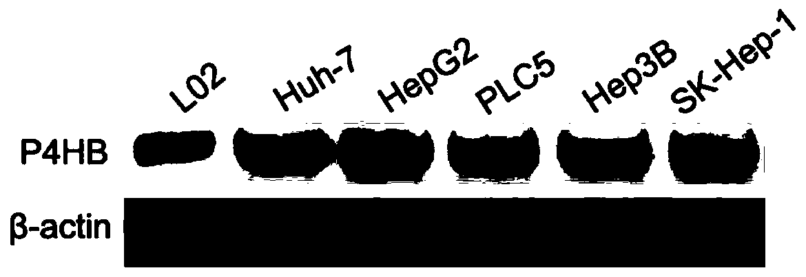 A kind of inhibitor of p4hb gene expression and its application