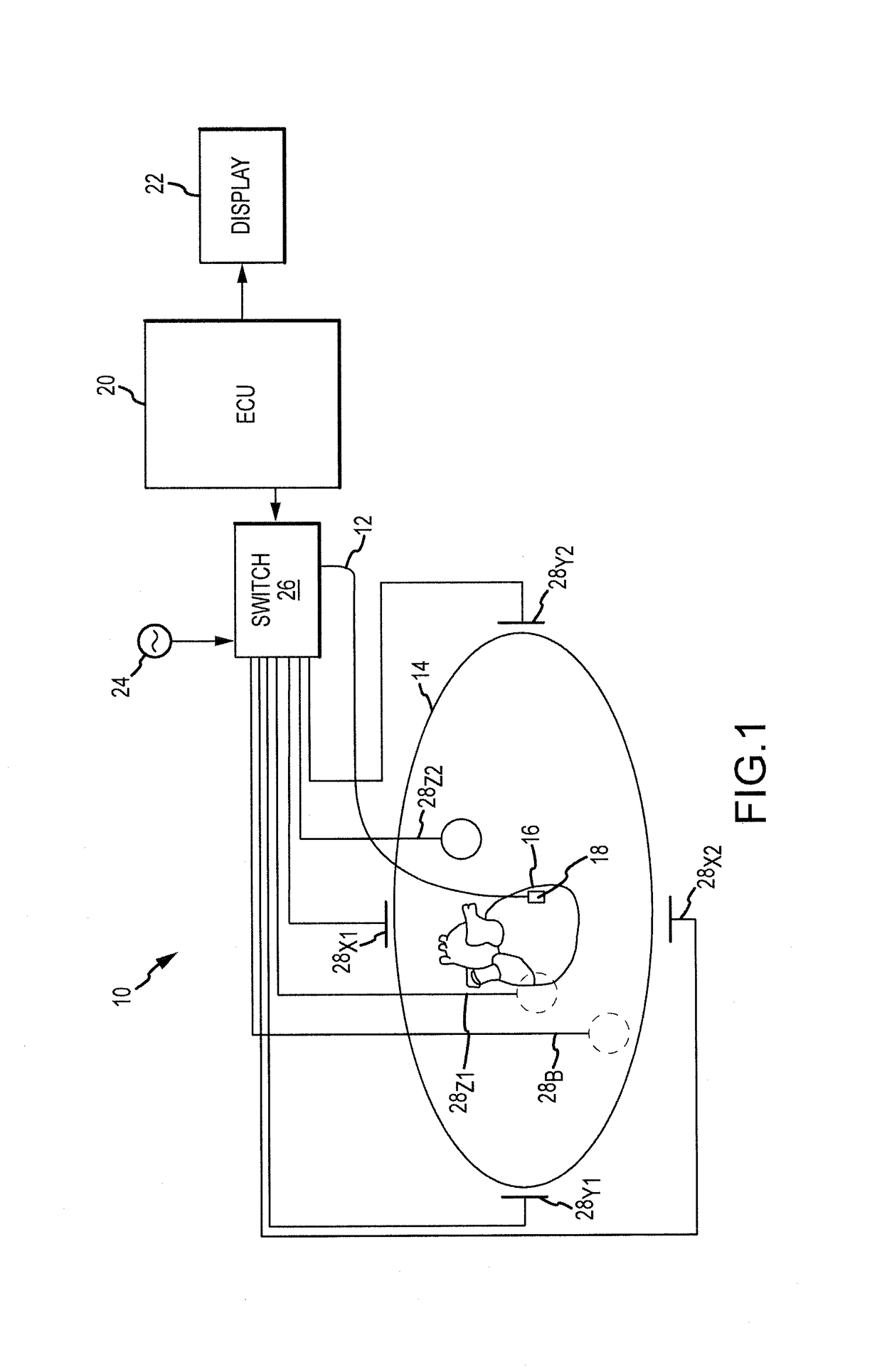 Scaling of electrical impedance-based navigation space using inter-electrode spacing