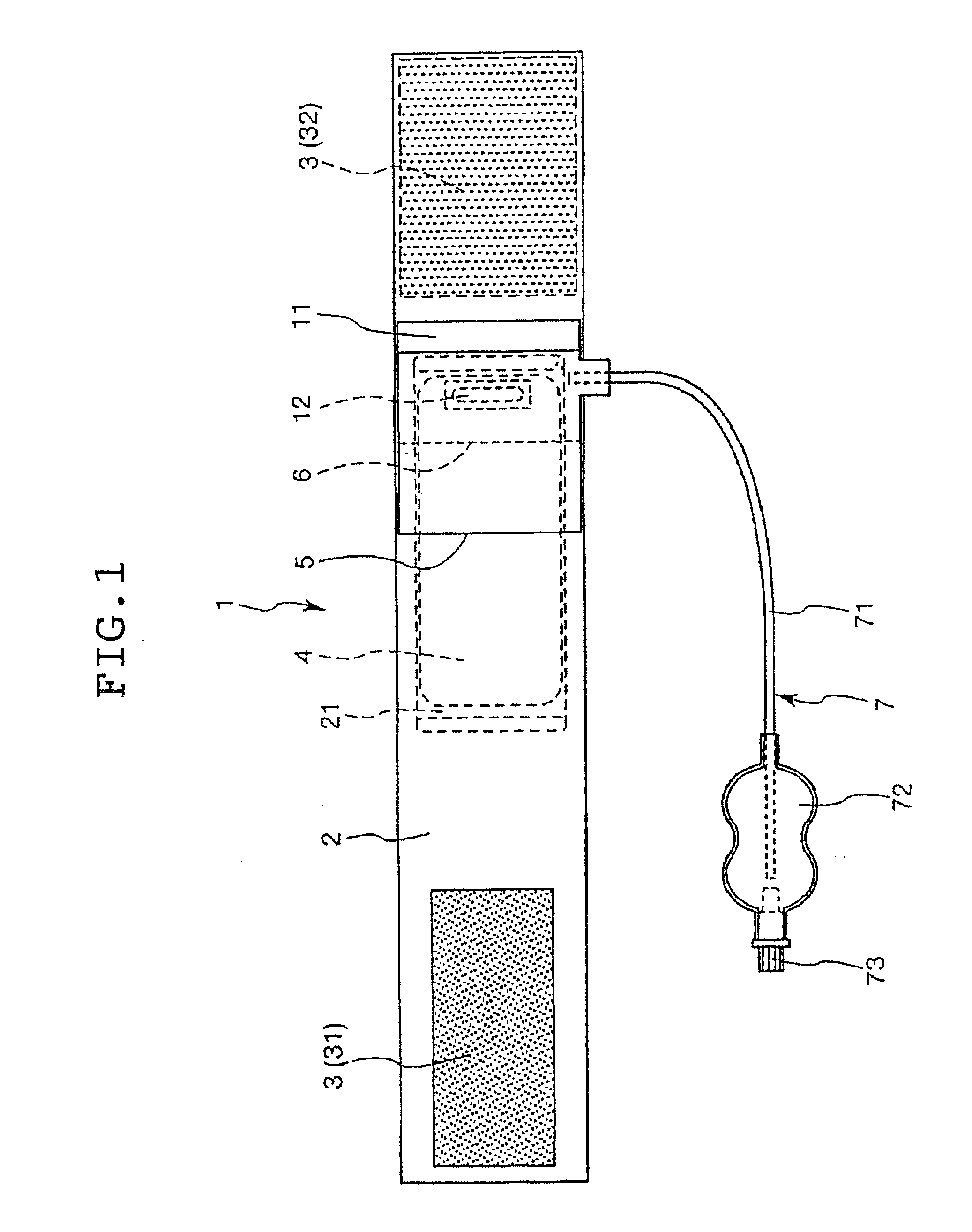 Method to stop bleeding at a puncture site of an artery of a patient's wrist