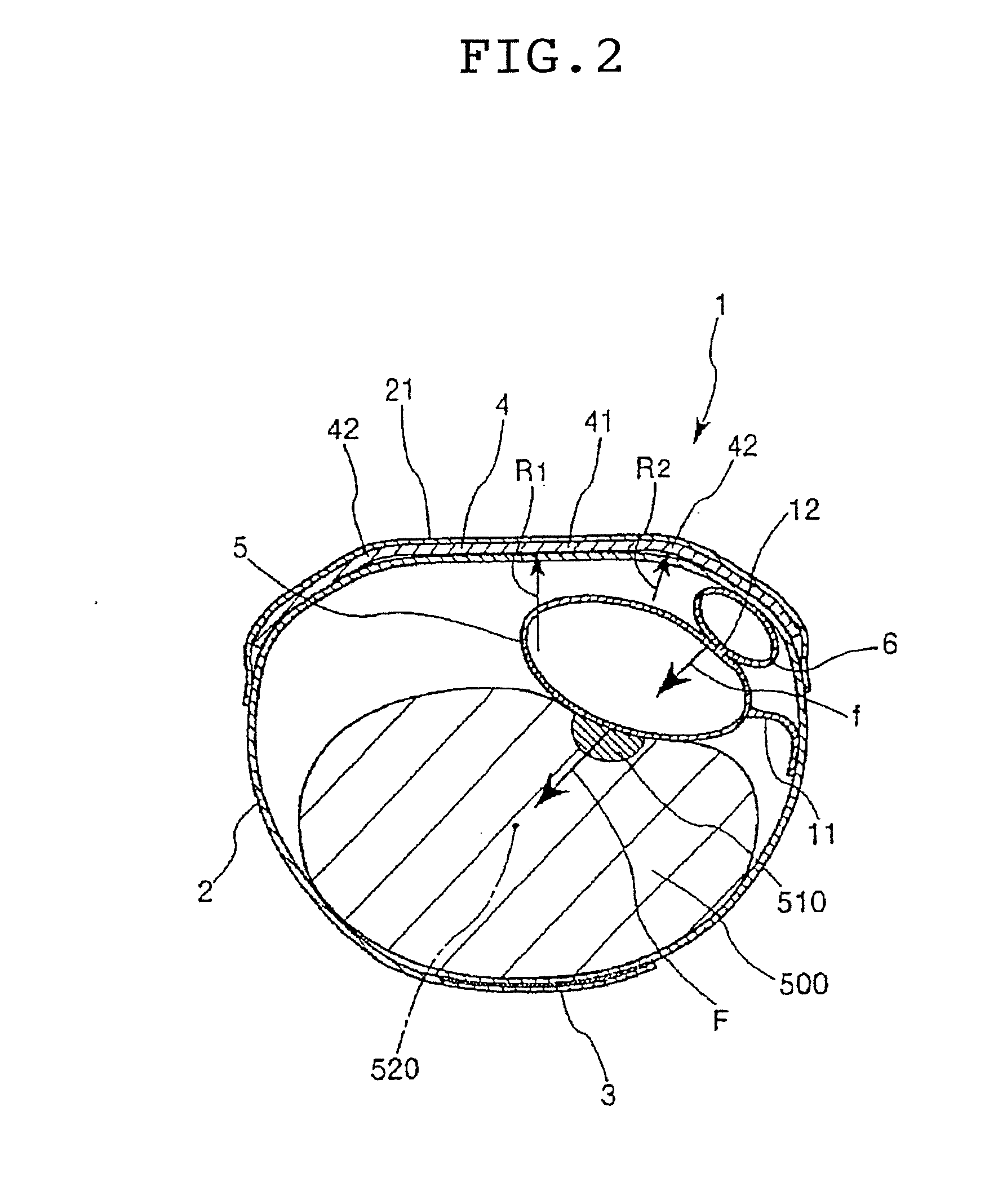 Method to stop bleeding at a puncture site of an artery of a patient's wrist