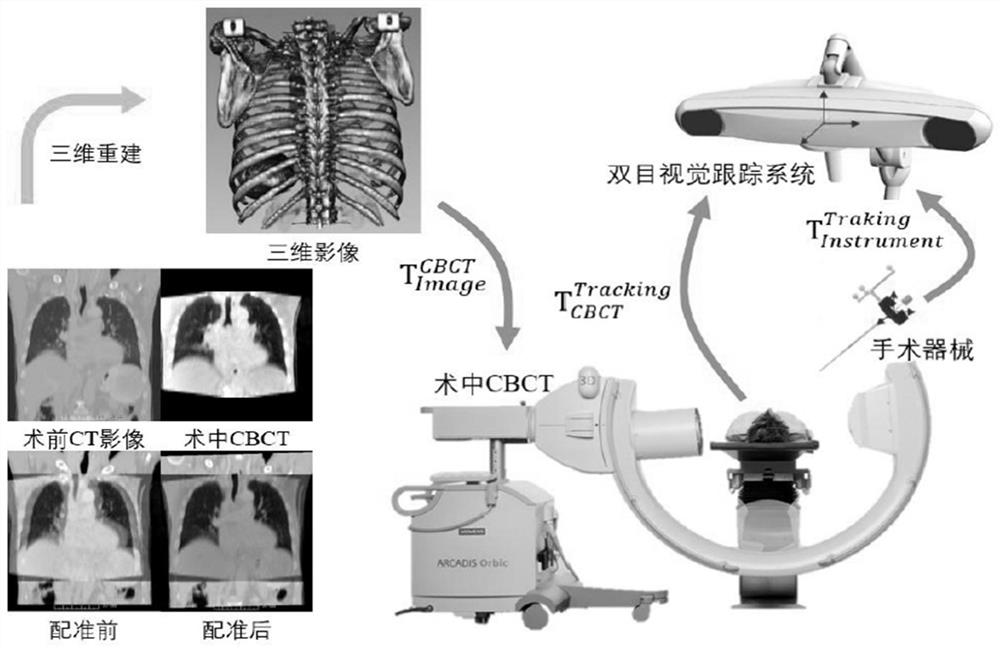 A navigation system for orthopedic surgery based on multimodal image fusion