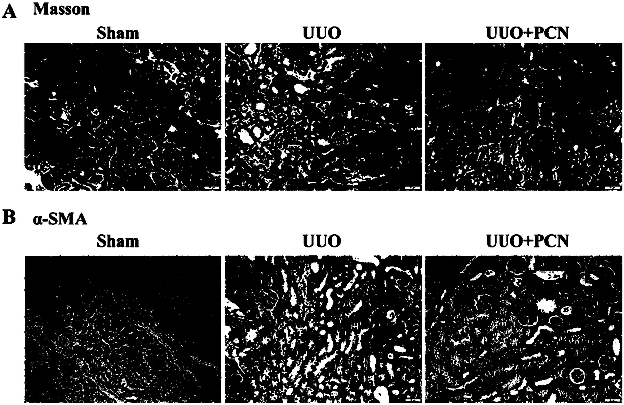 Application of PCN (Pregnenolone-16a-carbonitrile) to preparation of medicine for treating related diseases of chronic kidney diseases