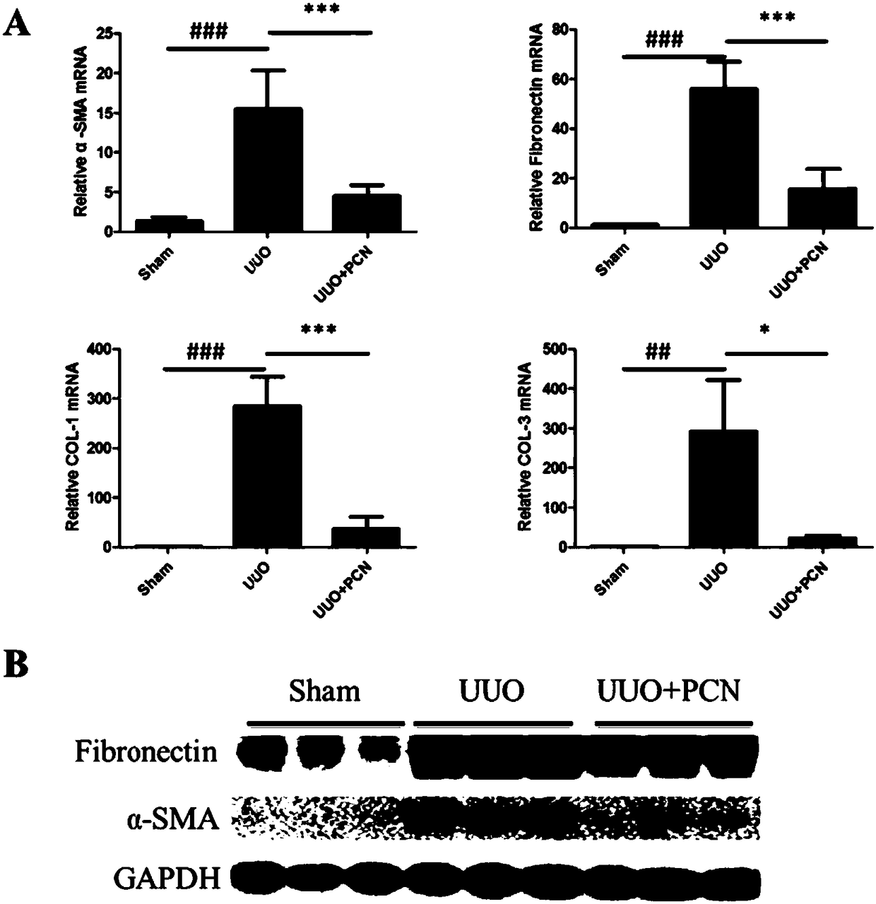 Application of PCN (Pregnenolone-16a-carbonitrile) to preparation of medicine for treating related diseases of chronic kidney diseases