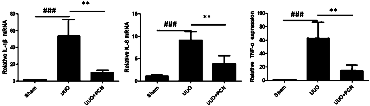 Application of PCN (Pregnenolone-16a-carbonitrile) to preparation of medicine for treating related diseases of chronic kidney diseases