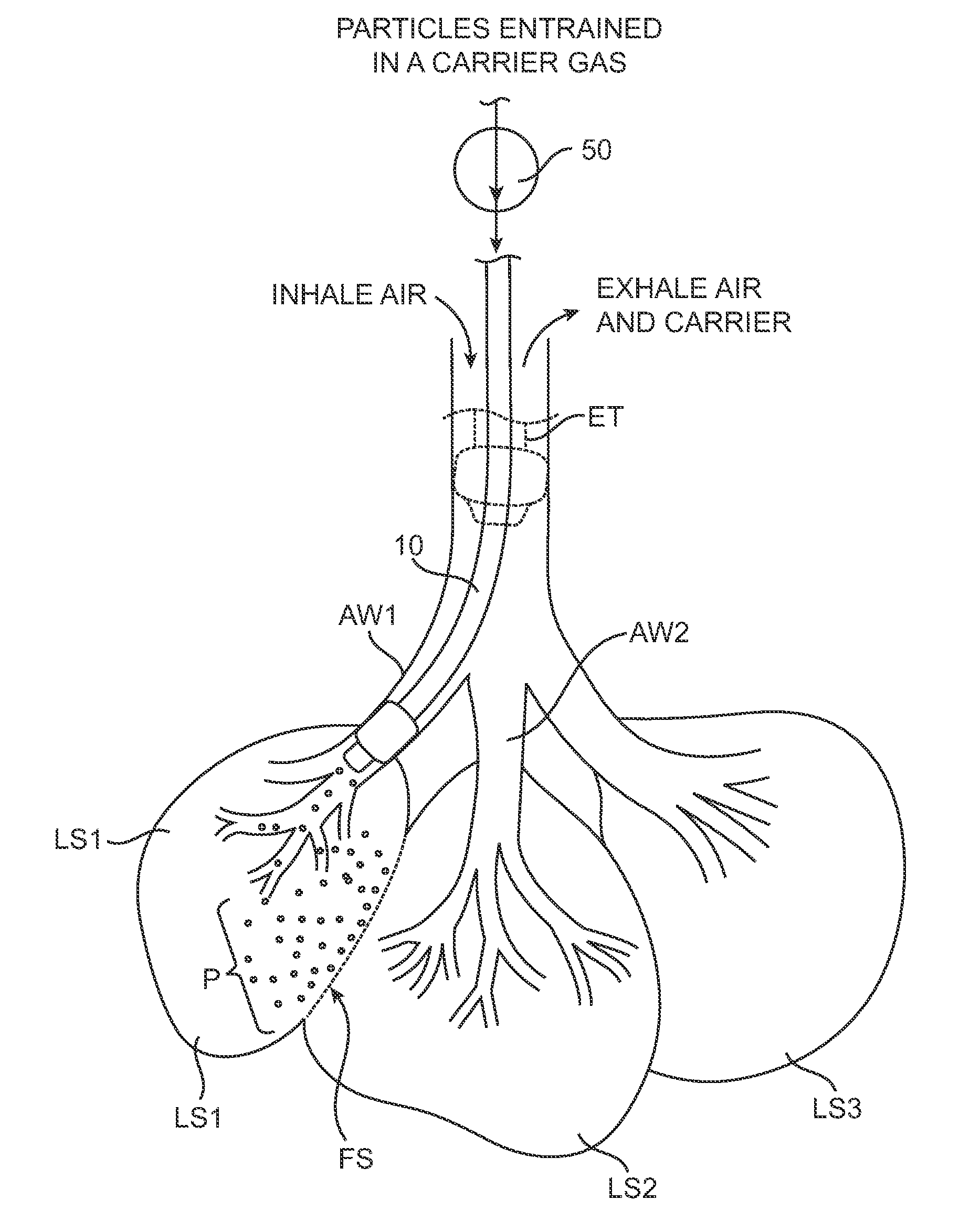 Methods and systems for occluding collateral flow channels in the lung