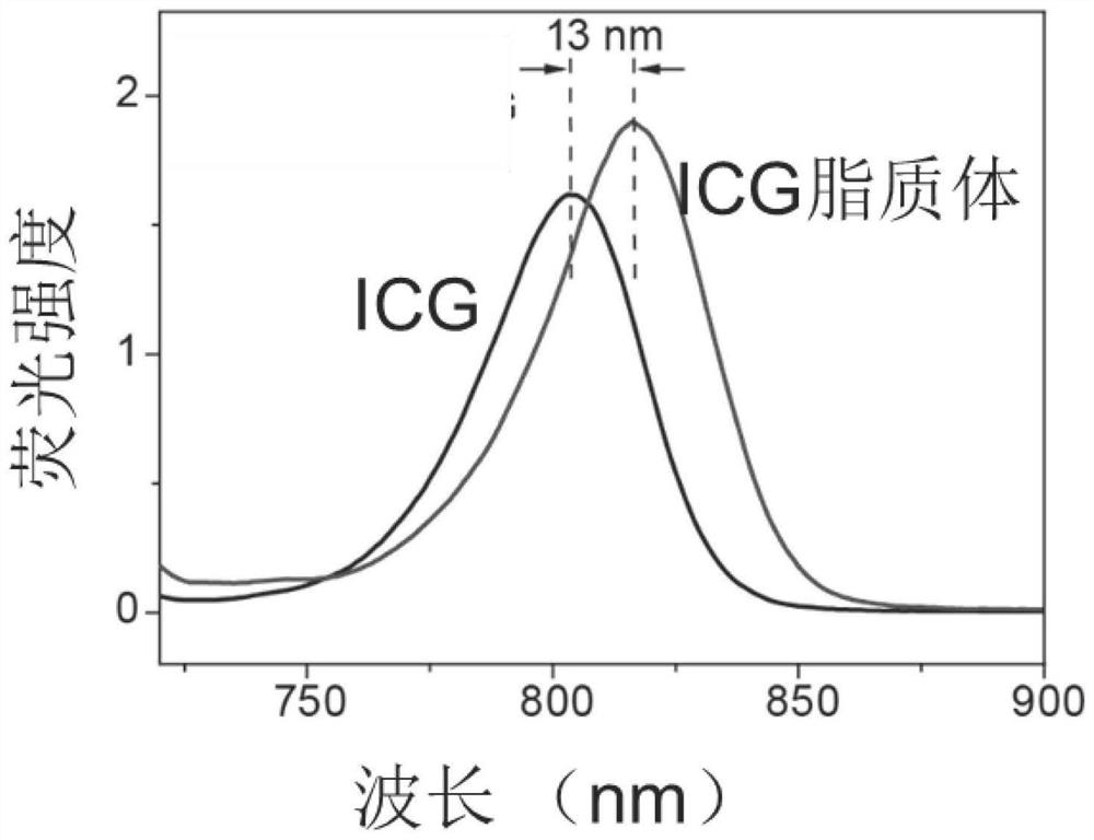 Indocyanine green liposome as well as large-scale preparation method and application thereof