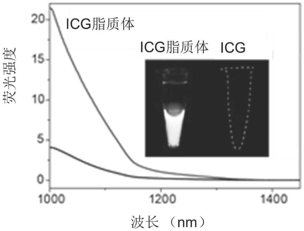 Indocyanine green liposome as well as large-scale preparation method and application thereof