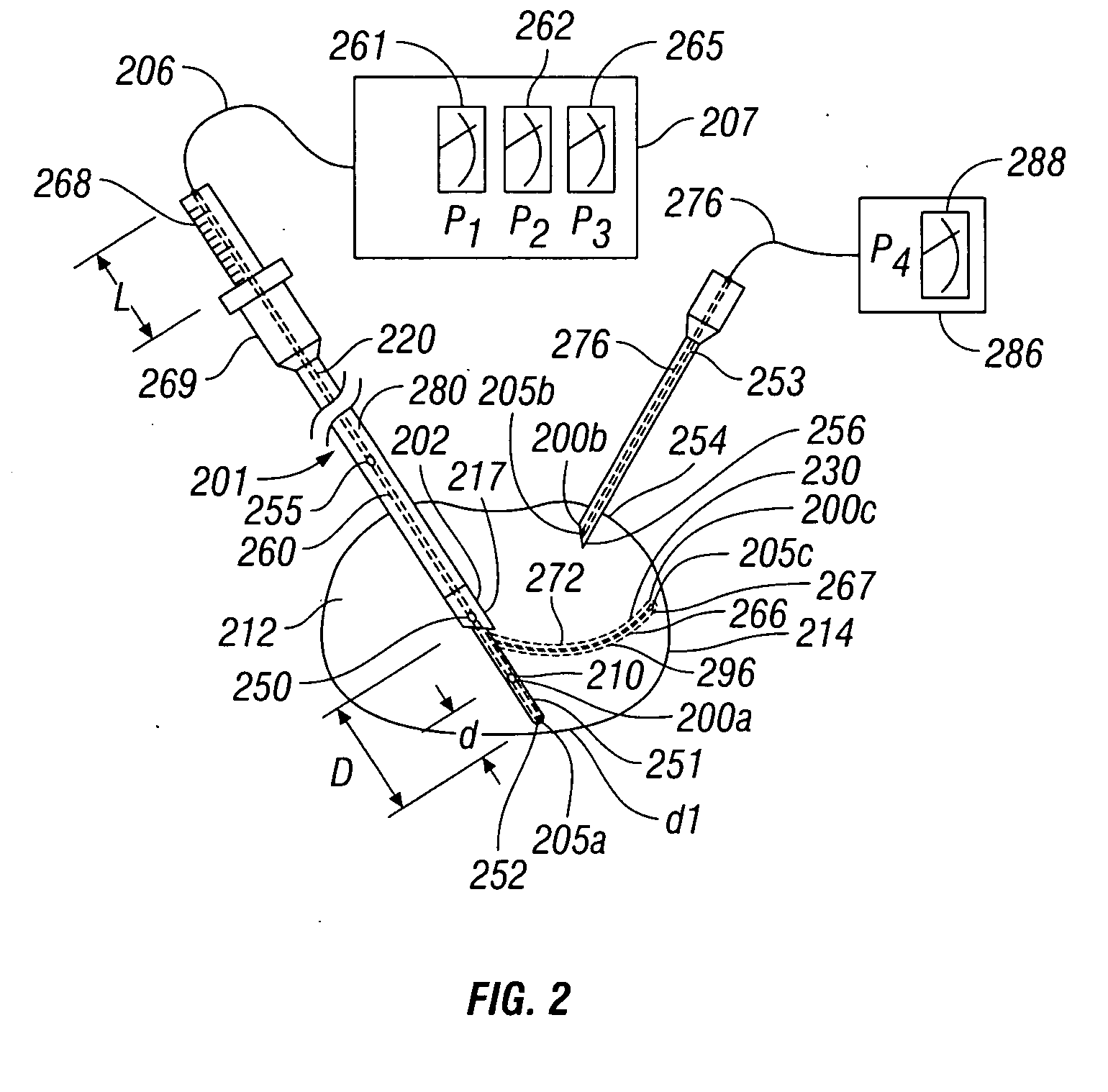 Method and apparatus for monitoring disc pressure during heat treatment of an intervertebral disc