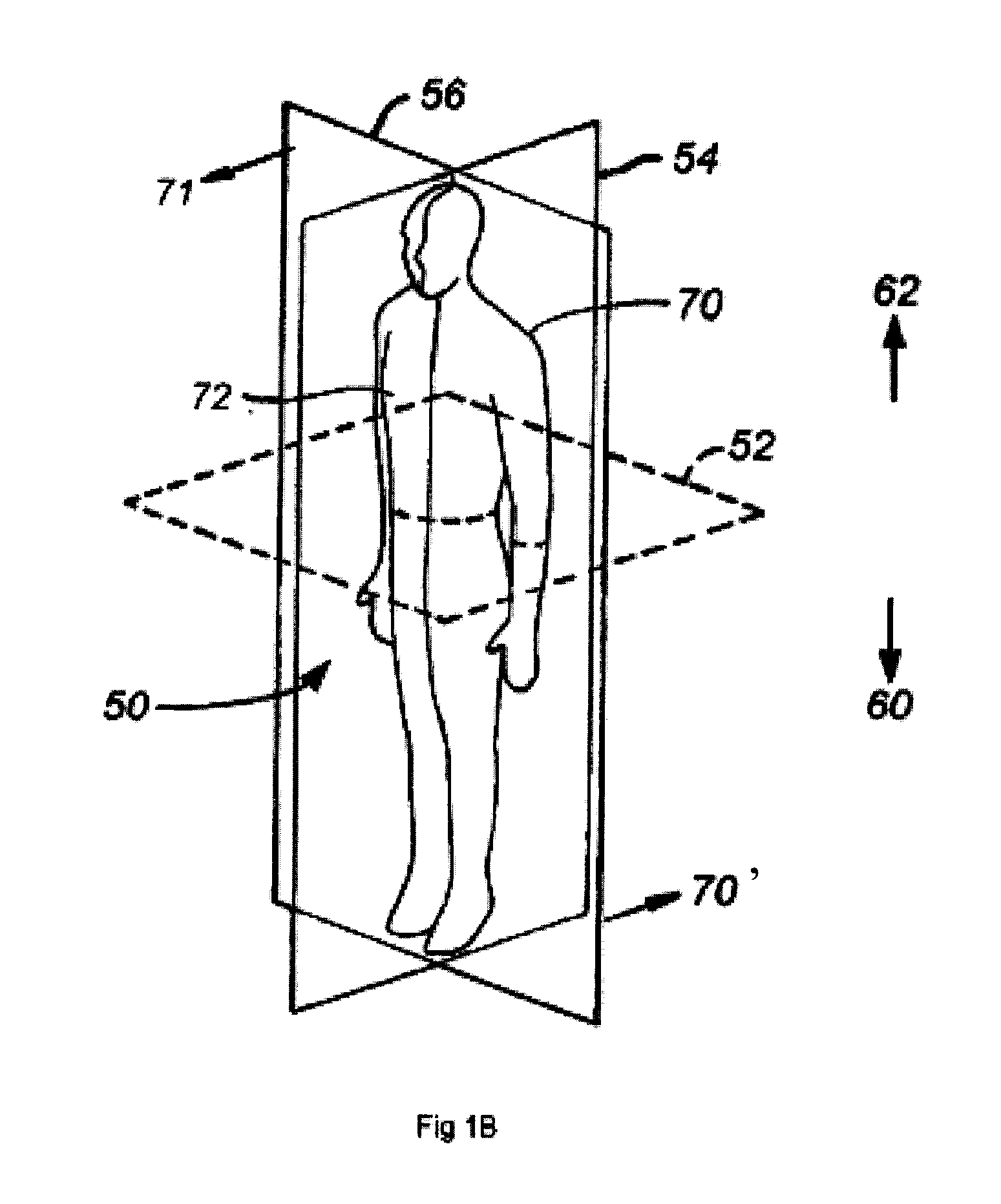 Methods, devices, systems, assemblies, and kits for tissue retraction in an oral cavity