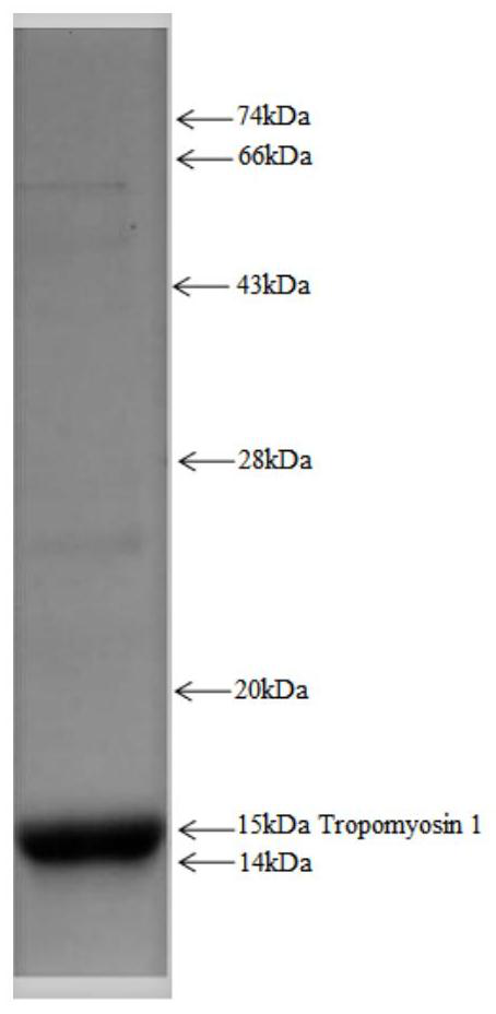 Kit for detecting antigen myosin 1-IgG antibody