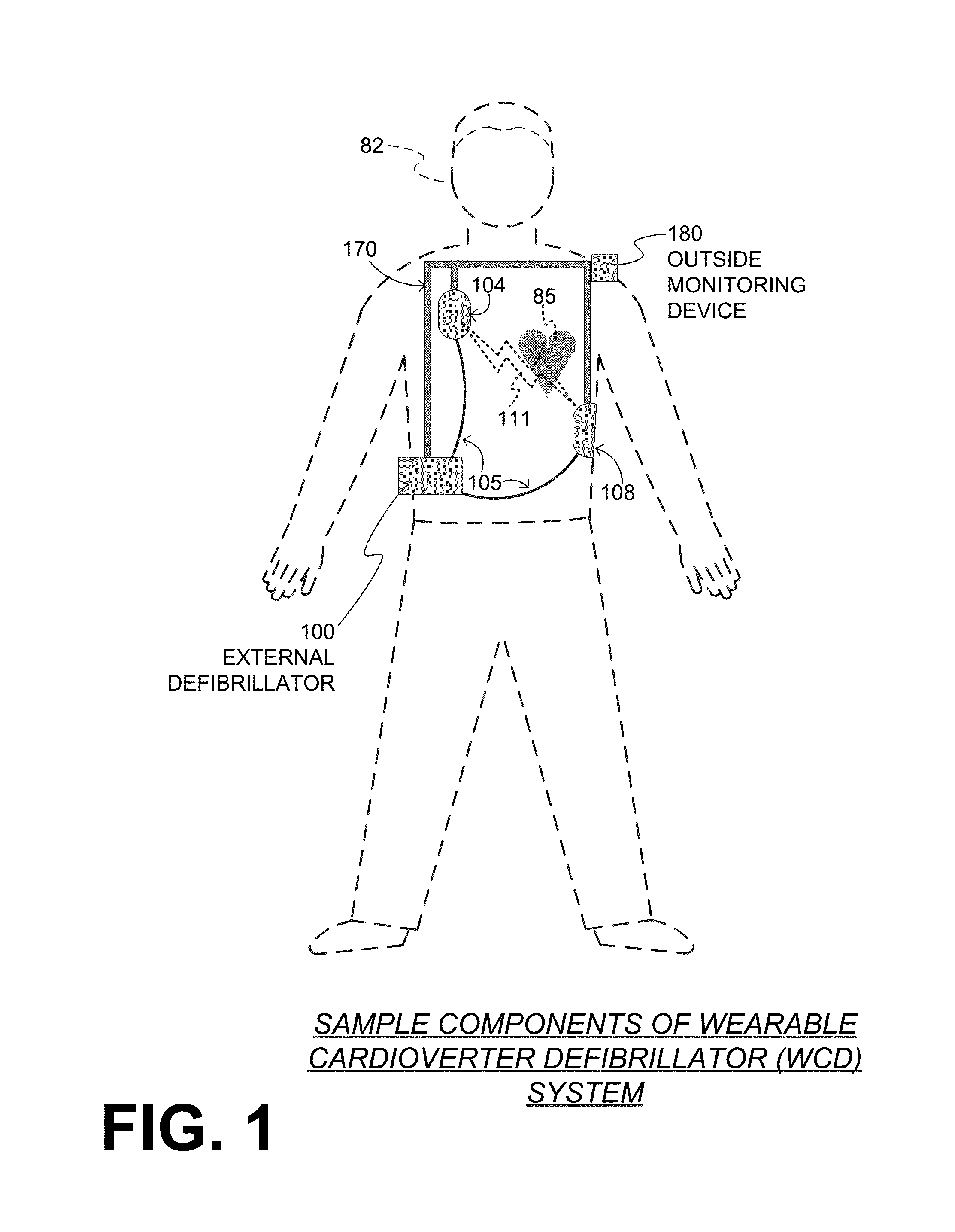 Wearable cardioverter defibrillator (WCD) system informing patient that it is validating just-detected cardiac arrhythmia