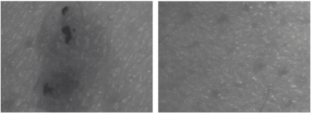 Treatment or prevention of seborrheic keratosis using artemisinin and derivatives thereof