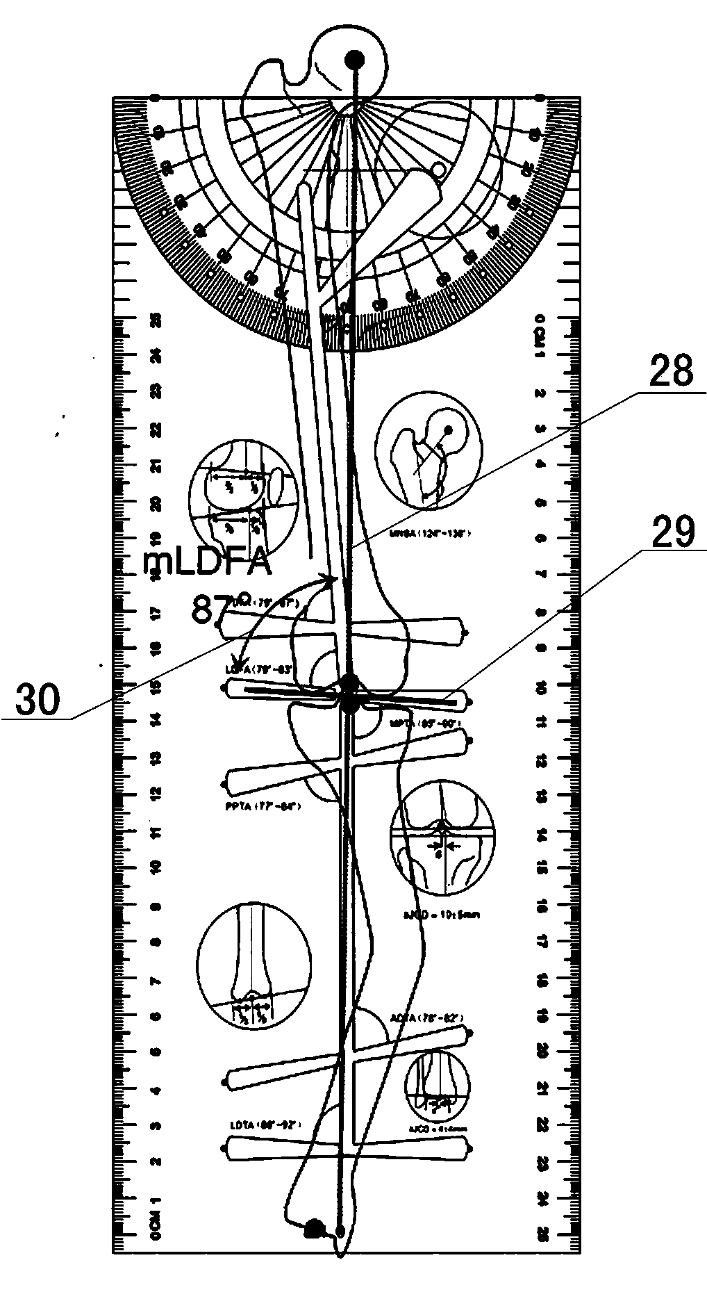 Lower limb orthopedic ruler