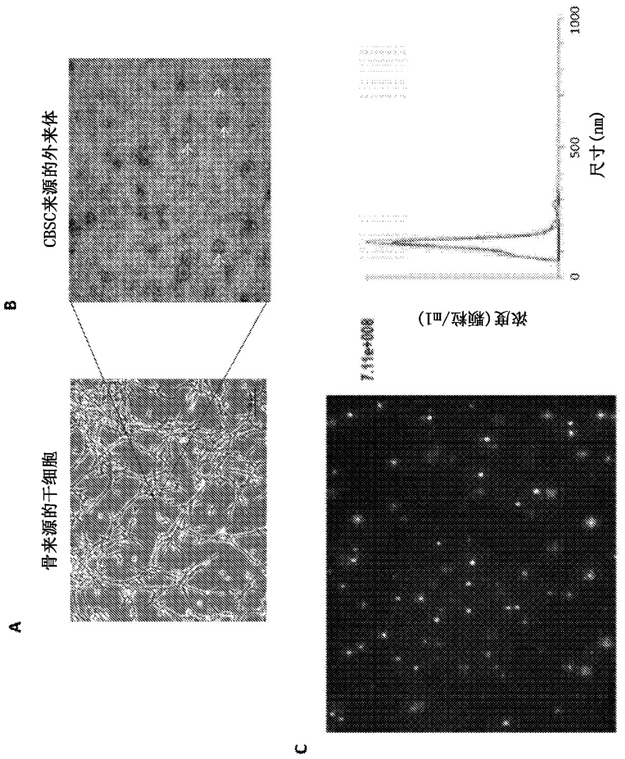 Augmenting heart function after cardiac injury with exosomes derived from cortical bone stem cells