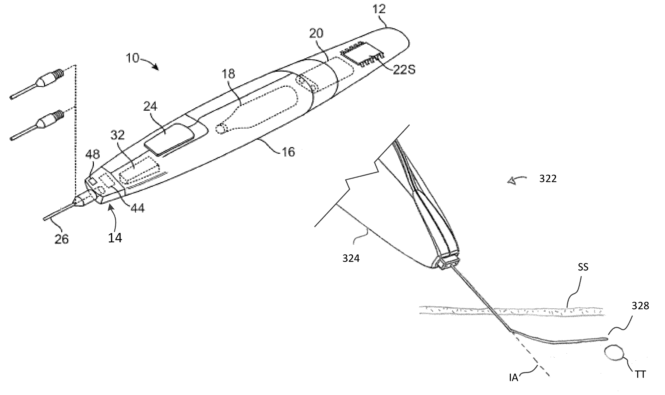 Methods and devices for pain management