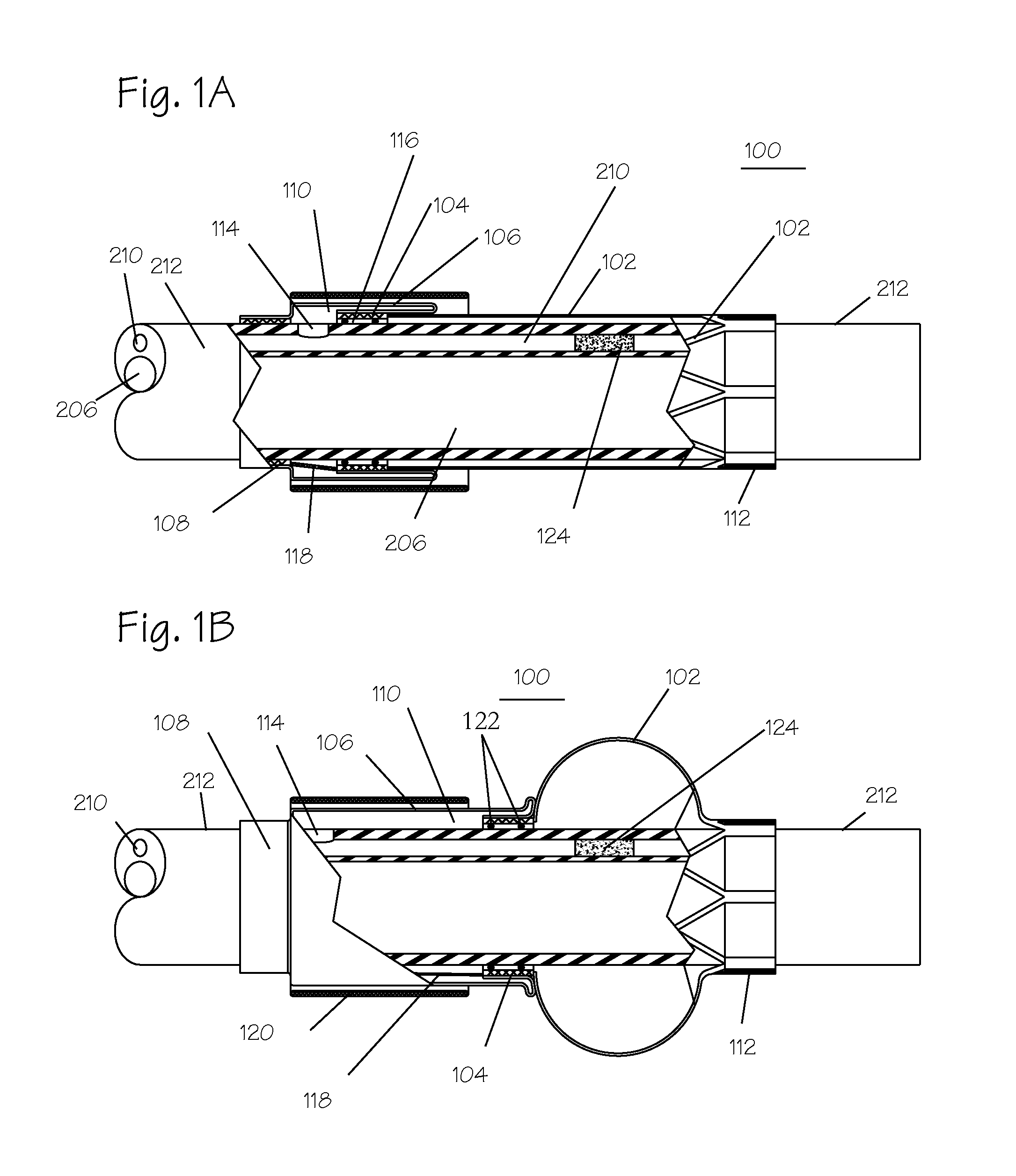 Pressure activated foreign body removal system and method of use