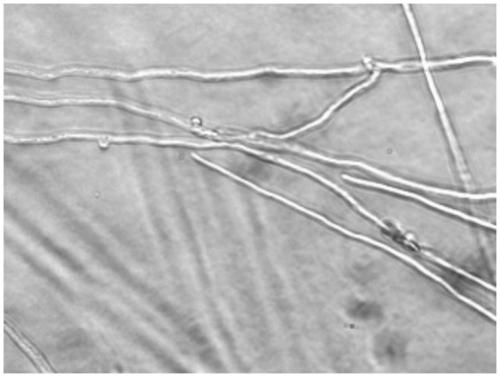 A method for protecting Pleurotus eryngii strains by using uracil auxotrophy