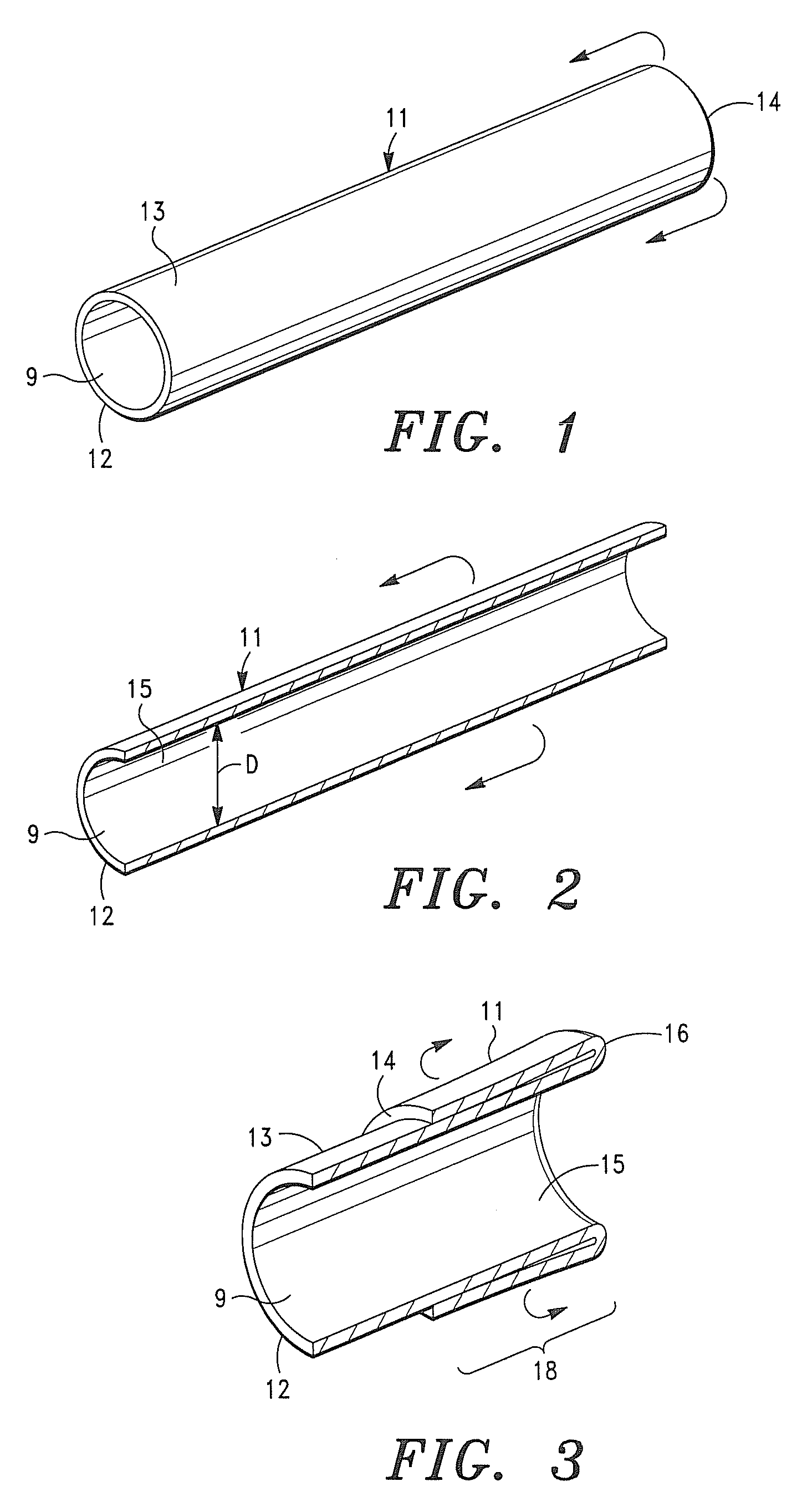 Tubular extracellular matrix prosthetic valve