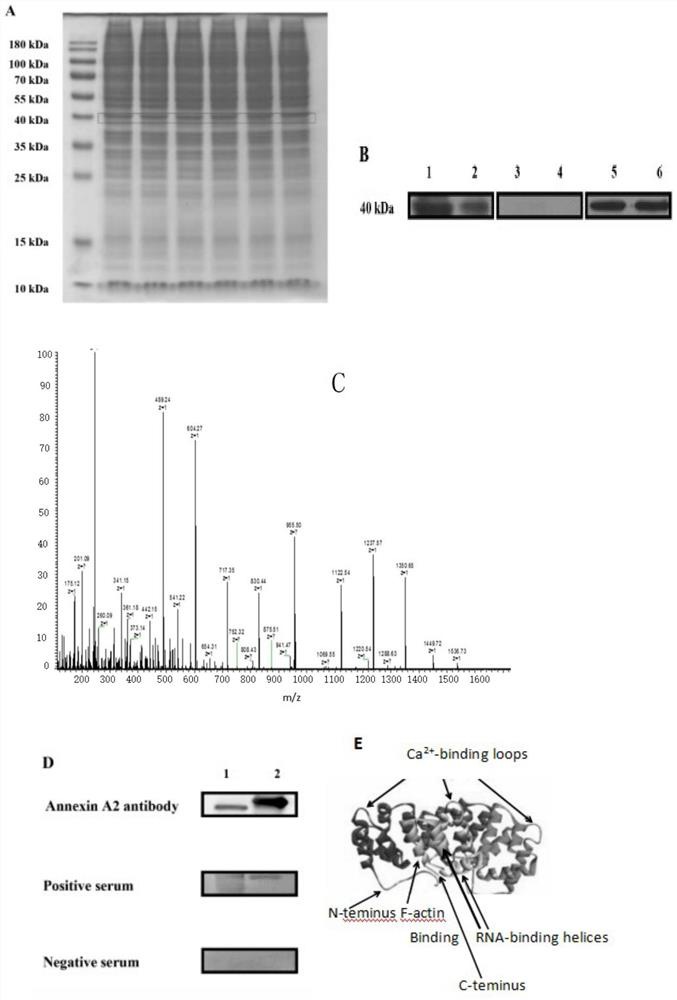 A kind of detection serum anti-annexin A  <sub>2</sub> -IgG antibody kit