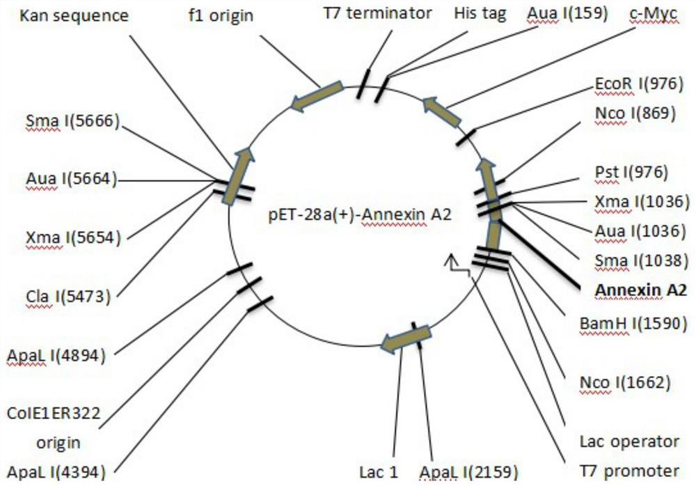 A kind of detection serum anti-annexin A  <sub>2</sub> -IgG antibody kit