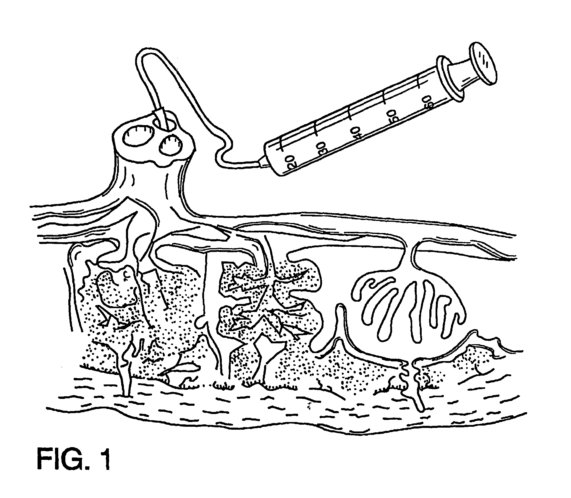 Tissue matrices comprising placental stem cells, and methods of making the same